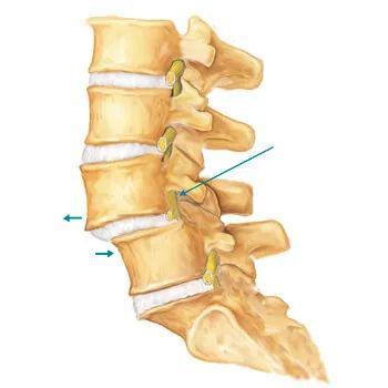 同仁医院熊猫体育官网这项技术让患者远离腰椎滑脱